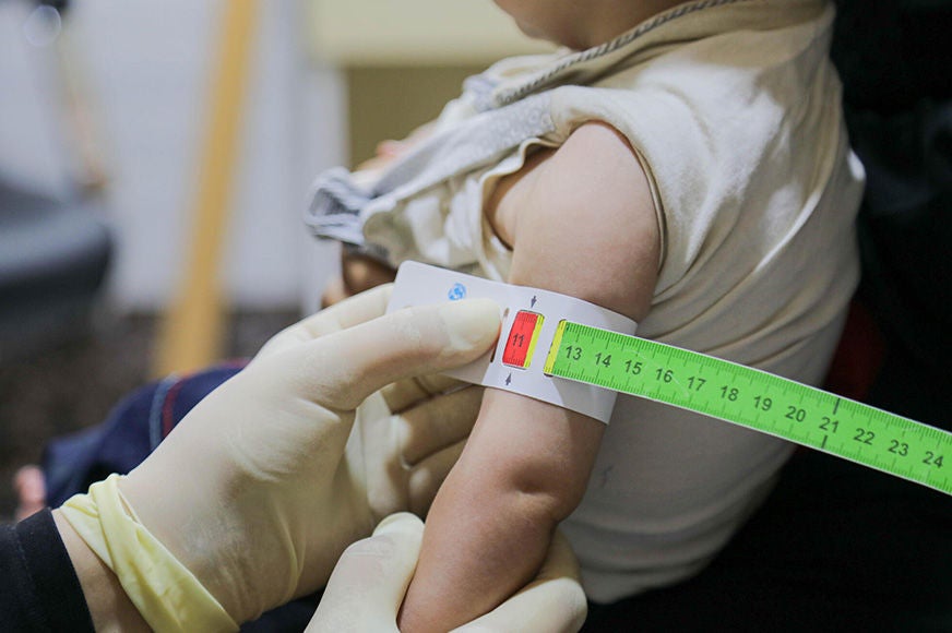 A child's arm is measured for a nutritional assessment during a World Vision Syria Response program. (Syria, 2016)