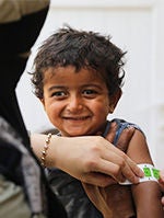 A World Vision staff member measuring a child's arm with a tape to assess nutritional risk.